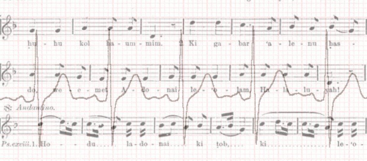 Hallel - The Song and the Echocardiogram
